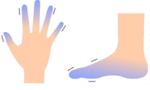 Bệnh lạnh tay chân