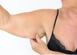 Cơ bắp bị nhão