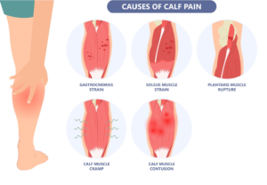 Cơ bắp chân bị cứng