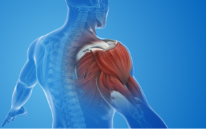 Nguyên nhân đau mỏi vai gáy