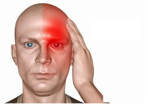 Phân tích nguyên nhân bệnh đau nửa đầu